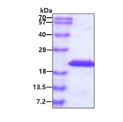 SDS-PAGE: Recombinant Mouse IL-36 alpha/IL-1F6 His Protein [NBP2-52168]